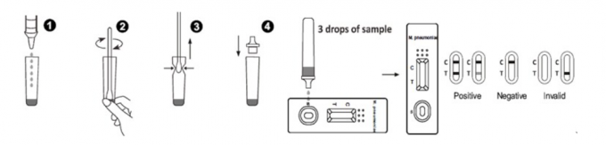 Mycoplasma Pneumoniae (MP) IgM Rapid Diagnostic Test Kit